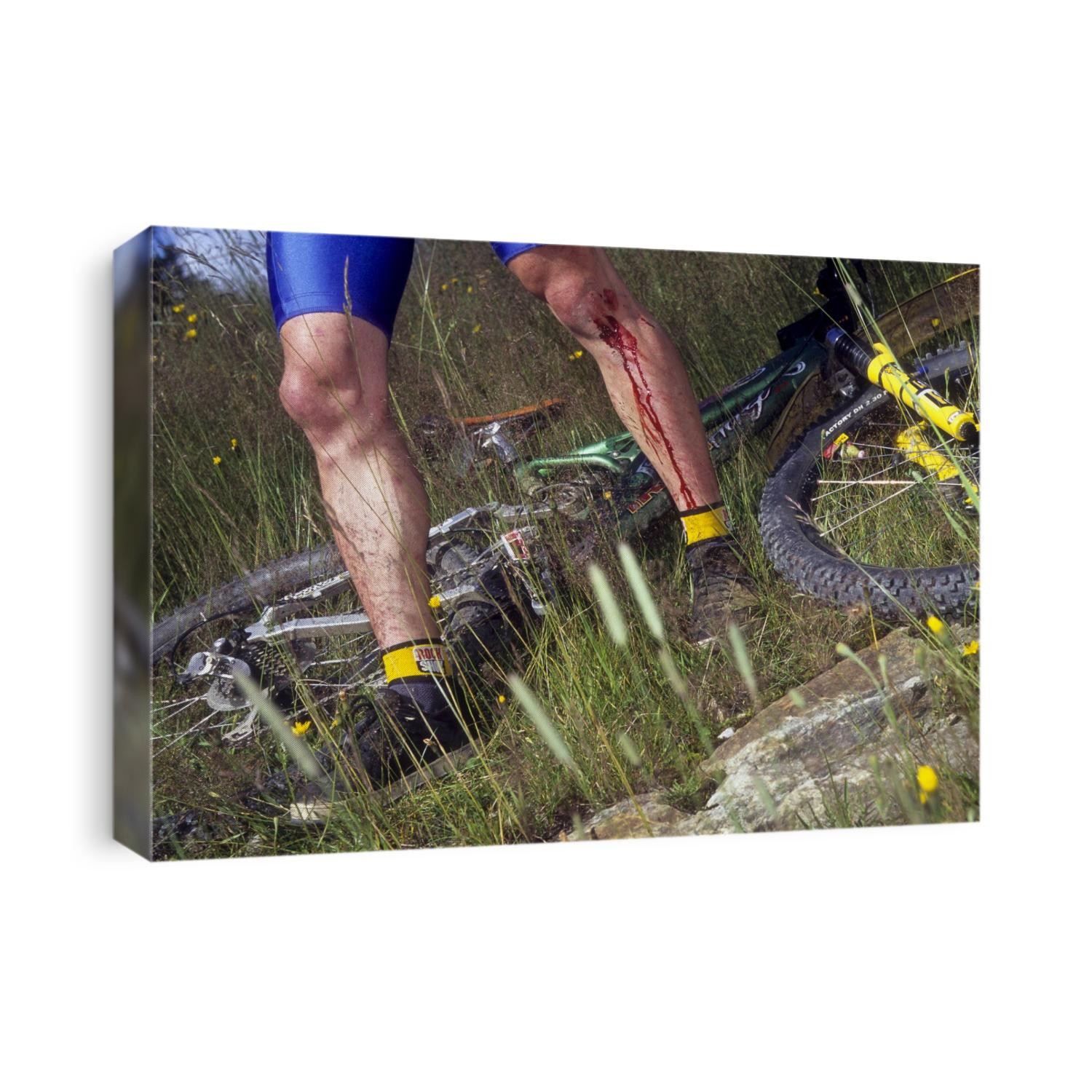 Injured mountain bicycllist.